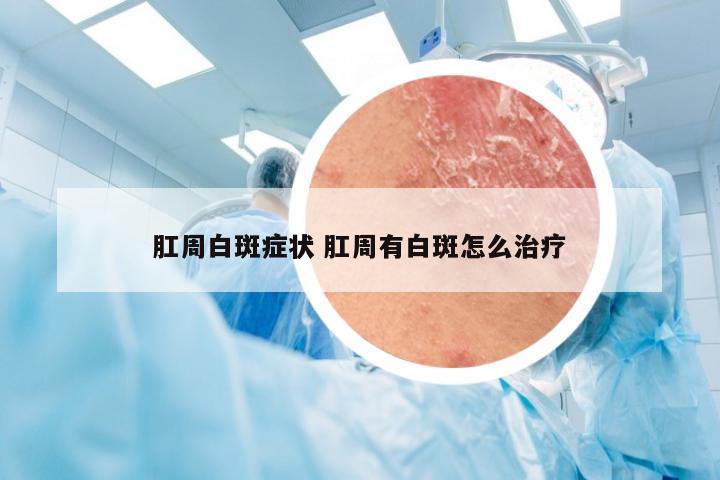 肛周白斑症状 肛周有白斑怎么治疗