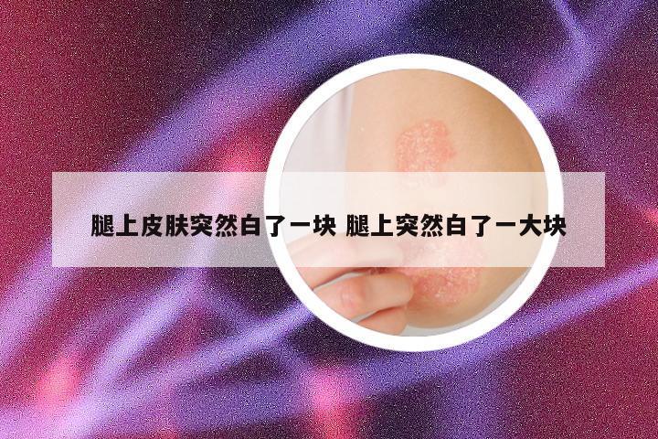 腿上皮肤突然白了一块 腿上突然白了一大块