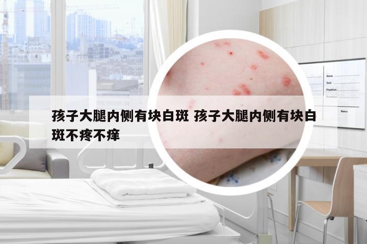 孩子大腿内侧有块白斑 孩子大腿内侧有块白斑不疼不痒