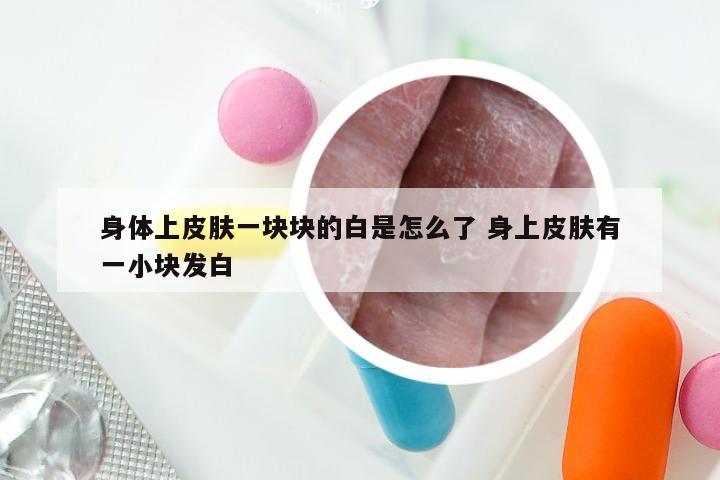 身体上皮肤一块块的白是怎么了 身上皮肤有一小块发白