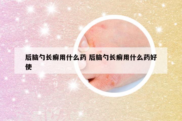 后脑勺长癣用什么药 后脑勺长癣用什么药好使