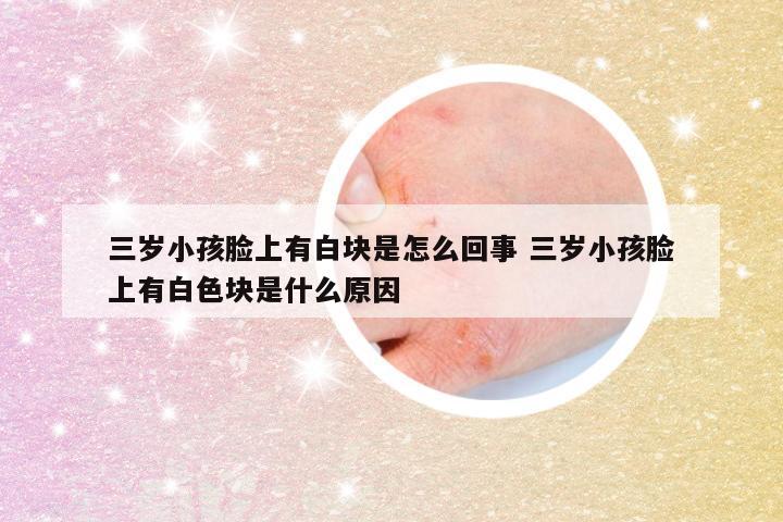 三岁小孩脸上有白块是怎么回事 三岁小孩脸上有白色块是什么原因