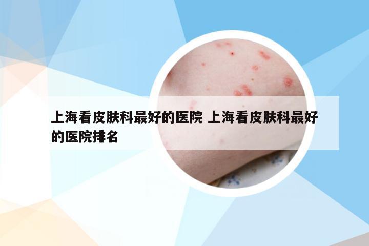 上海看皮肤科最好的医院 上海看皮肤科最好的医院排名