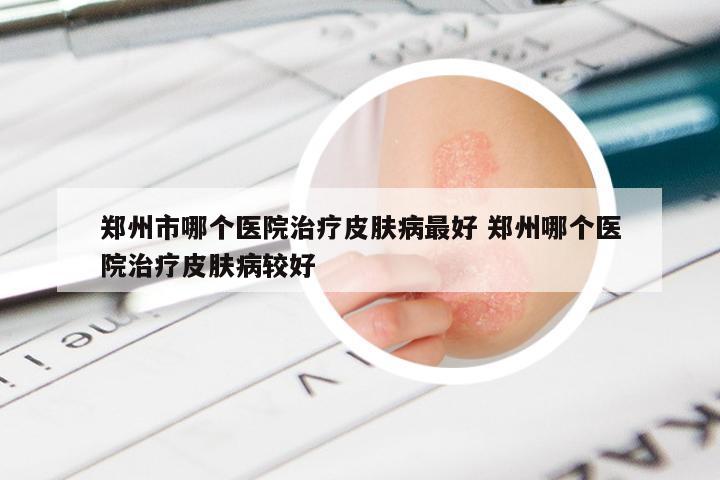 郑州市哪个医院治疗皮肤病最好 郑州哪个医院治疗皮肤病较好