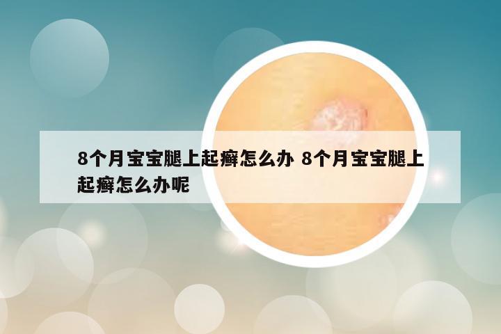 8个月宝宝腿上起癣怎么办 8个月宝宝腿上起癣怎么办呢