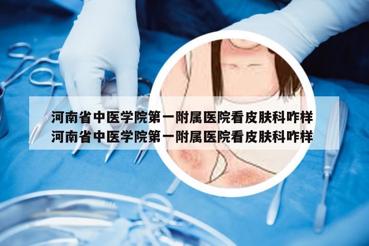 河南省中医学院第一附属医院看皮肤科咋样 河南省中医学院第一附属医院看皮肤科咋样