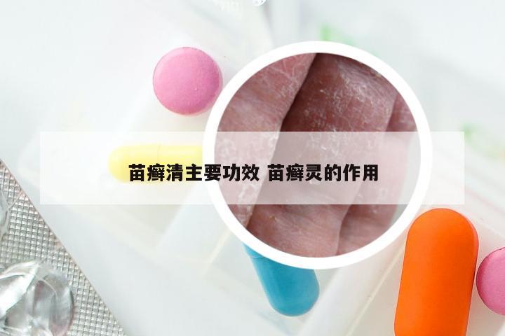 苗癣清主要功效 苗癣灵的作用