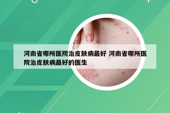 河南省哪所医院治皮肤病最好 河南省哪所医院治皮肤病最好的医生