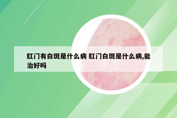 肛门有白斑是什么病 肛门白斑是什么病,能治好吗