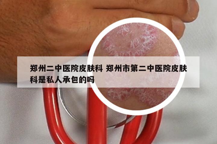 郑州二中医院皮肤科 郑州市第二中医院皮肤科是私人承包的吗