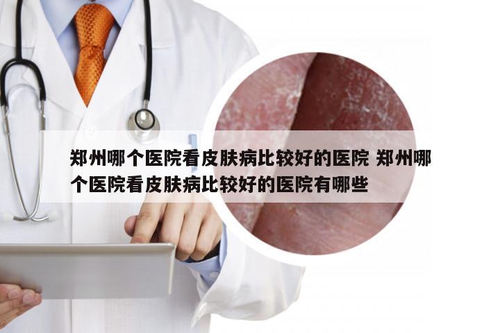 郑州哪个医院看皮肤病比较好的医院 郑州哪个医院看皮肤病比较好的医院有哪些
