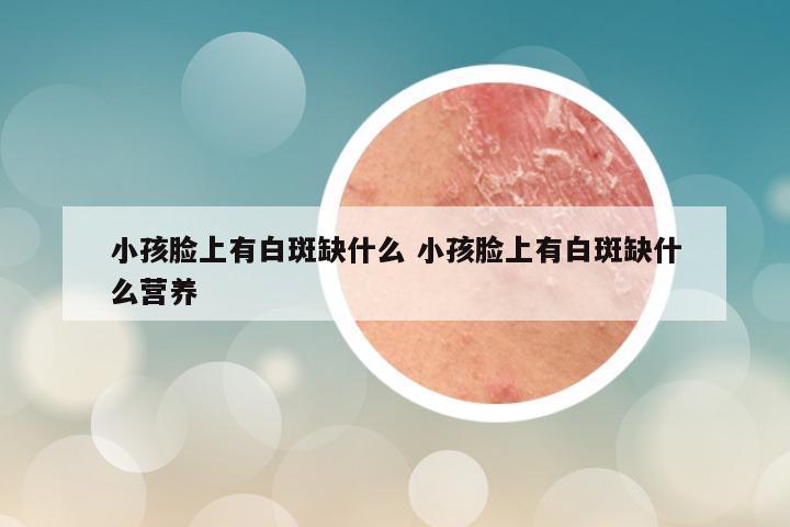 小孩脸上有白斑缺什么 小孩脸上有白斑缺什么营养