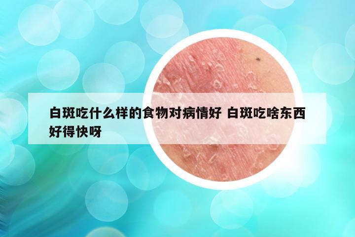 白斑吃什么样的食物对病情好 白斑吃啥东西好得快呀