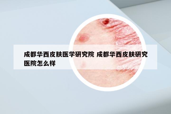 成都华西皮肤医学研究院 成都华西皮肤研究医院怎么样