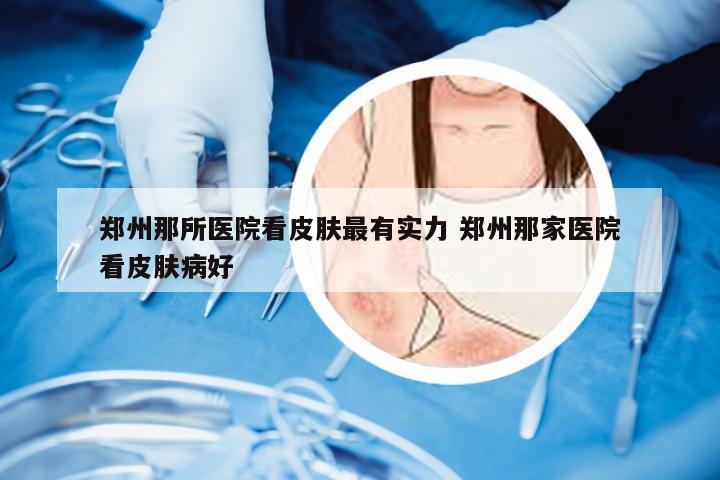 郑州那所医院看皮肤最有实力 郑州那家医院看皮肤病好