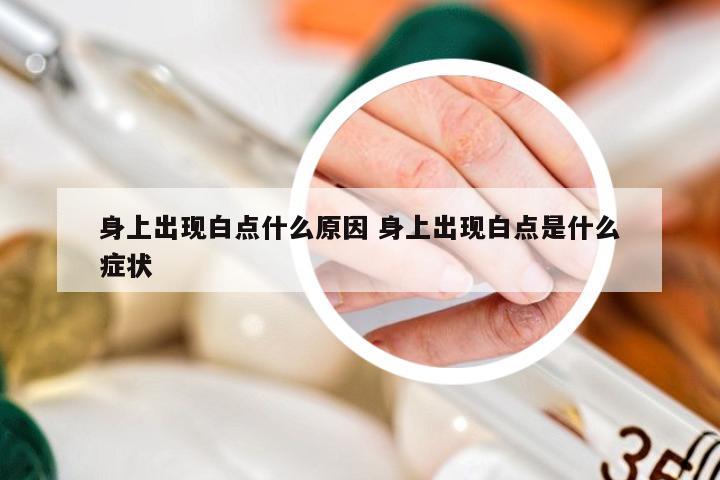 身上出现白点什么原因 身上出现白点是什么症状