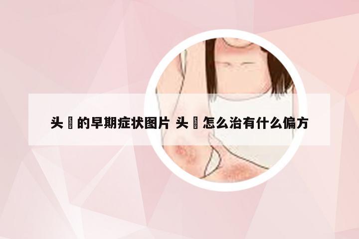 头廯的早期症状图片 头廯怎么治有什么偏方