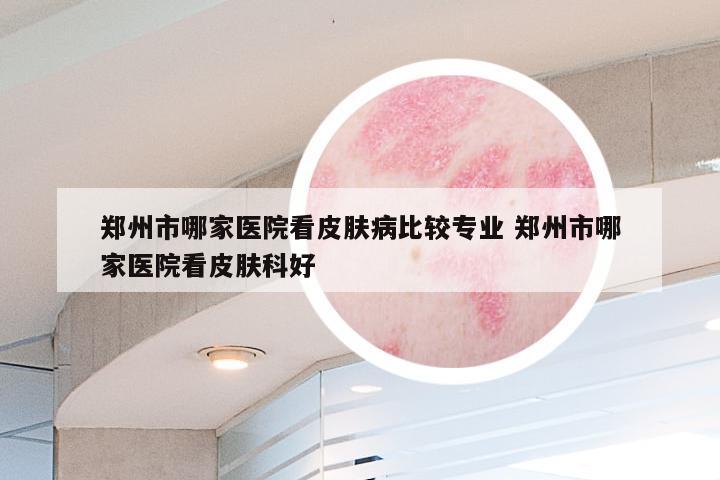 郑州市哪家医院看皮肤病比较专业 郑州市哪家医院看皮肤科好