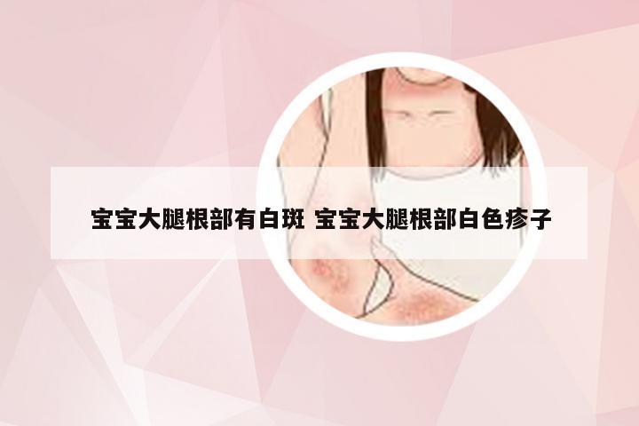 宝宝大腿根部有白斑 宝宝大腿根部白色疹子