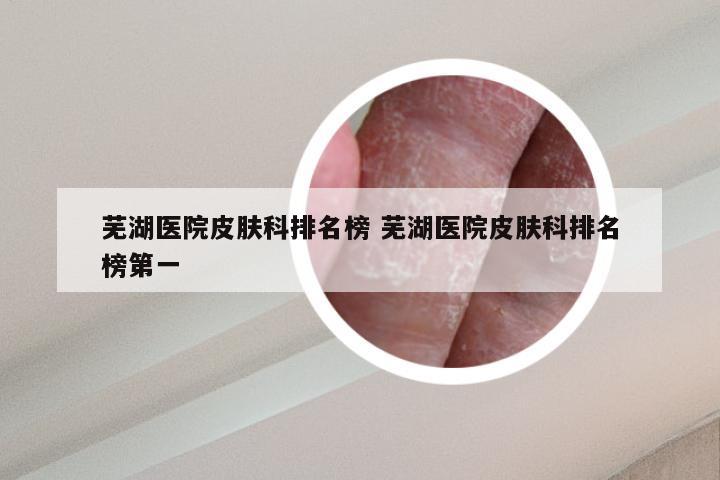 芜湖医院皮肤科排名榜 芜湖医院皮肤科排名榜第一