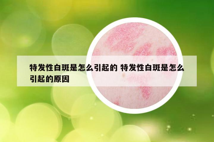 特发性白斑是怎么引起的 特发性白斑是怎么引起的原因