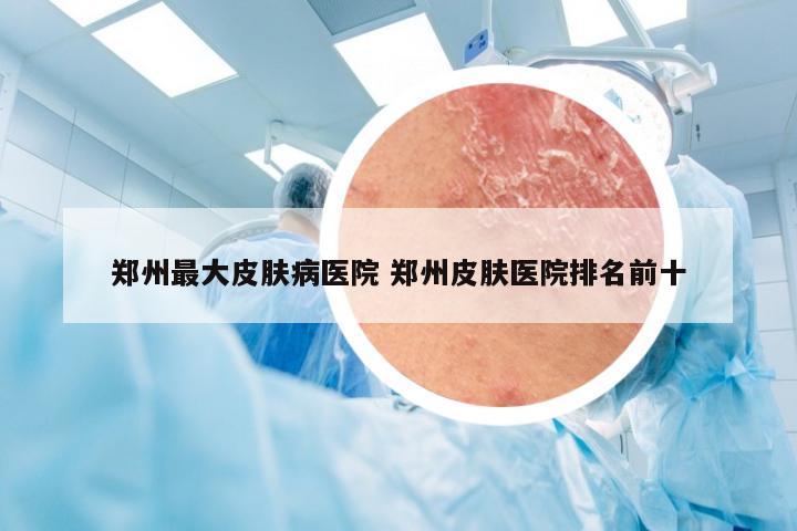 郑州最大皮肤病医院 郑州皮肤医院排名前十