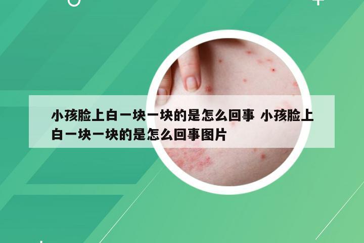 小孩脸上白一块一块的是怎么回事 小孩脸上白一块一块的是怎么回事图片