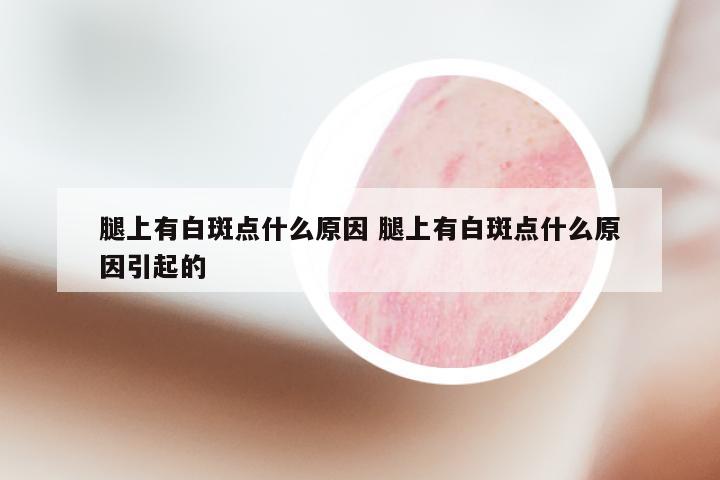 腿上有白斑点什么原因 腿上有白斑点什么原因引起的