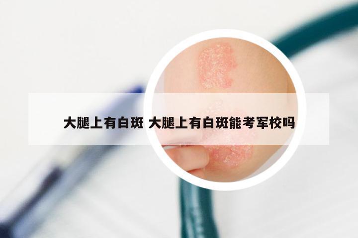 大腿上有白斑 大腿上有白斑能考军校吗