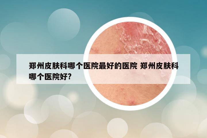 郑州皮肤科哪个医院最好的医院 郑州皮肤科哪个医院好?