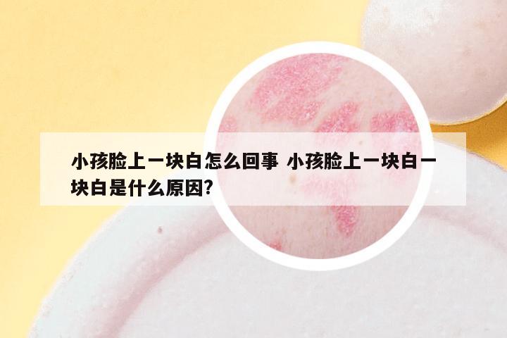 小孩脸上一块白怎么回事 小孩脸上一块白一块白是什么原因?