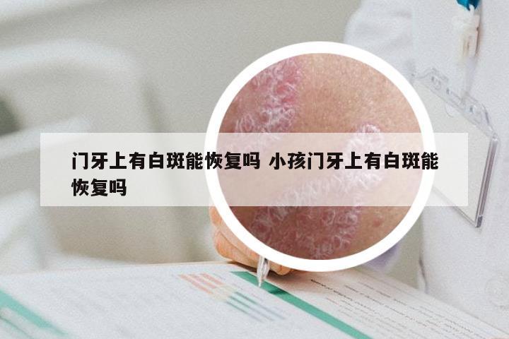 门牙上有白斑能恢复吗 小孩门牙上有白斑能恢复吗