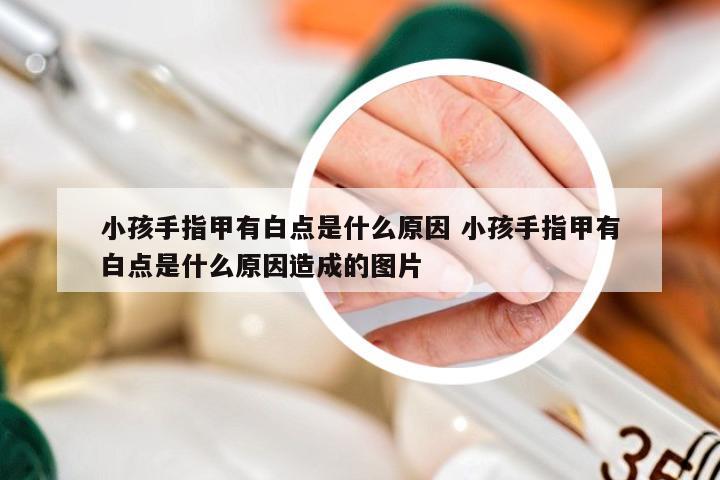 小孩手指甲有白点是什么原因 小孩手指甲有白点是什么原因造成的图片