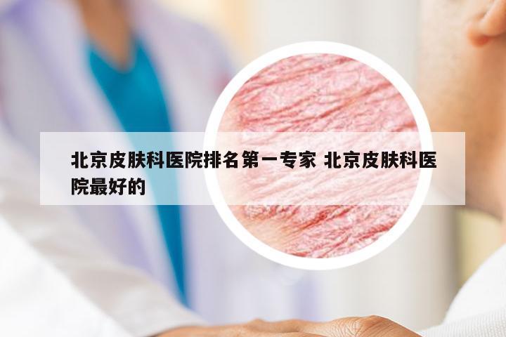 北京皮肤科医院排名第一专家 北京皮肤科医院最好的