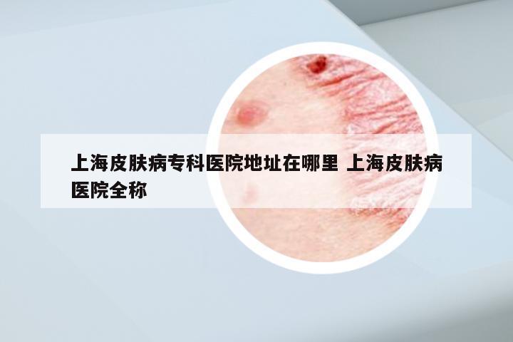 上海皮肤病专科医院地址在哪里 上海皮肤病医院全称