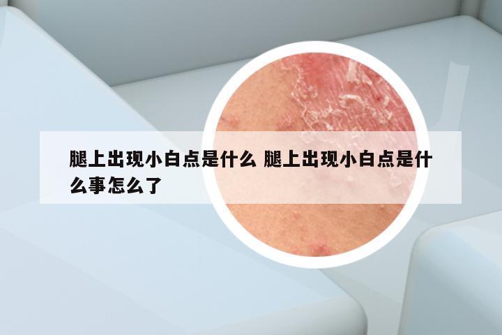 腿上出现小白点是什么 腿上出现小白点是什么事怎么了