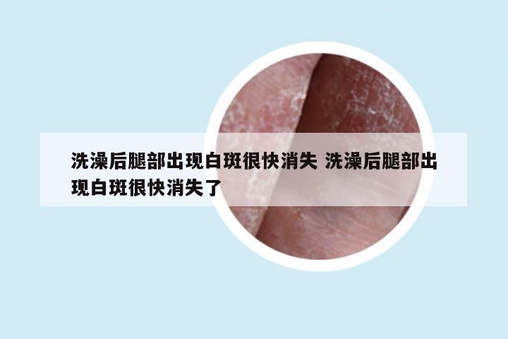 洗澡后腿部出现白斑很快消失 洗澡后腿部出现白斑很快消失了