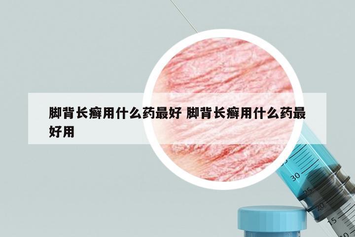 脚背长癣用什么药最好 脚背长癣用什么药最好用