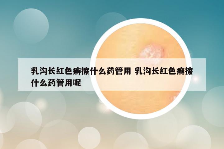 乳沟长红色癣擦什么药管用 乳沟长红色癣擦什么药管用呢