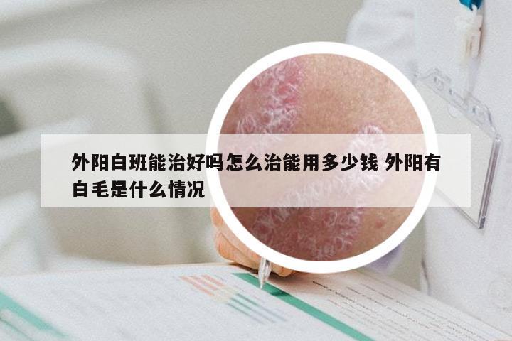 外阳白班能治好吗怎么治能用多少钱 外阳有白毛是什么情况