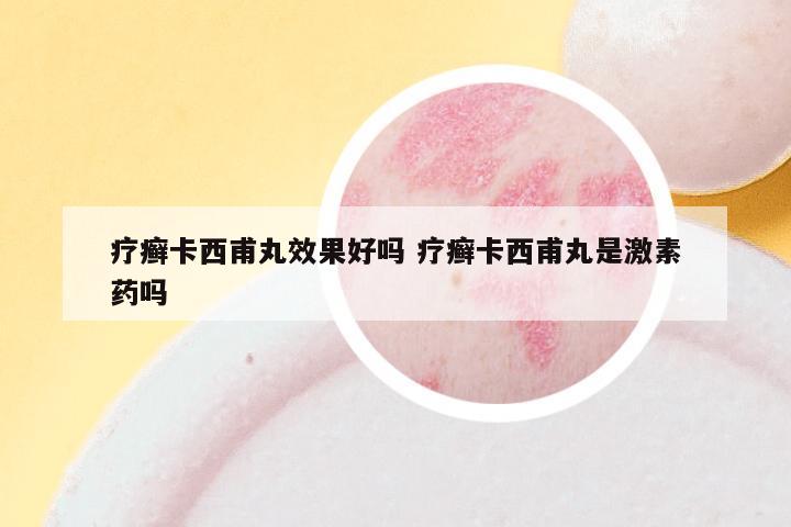 疗癣卡西甫丸效果好吗 疗癣卡西甫丸是激素药吗