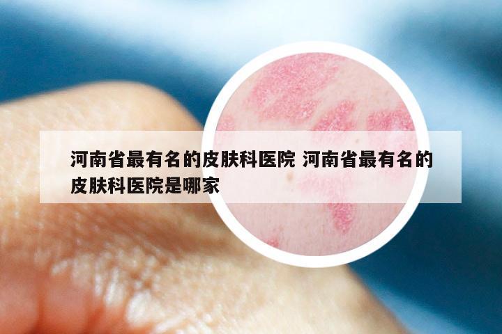 河南省最有名的皮肤科医院 河南省最有名的皮肤科医院是哪家