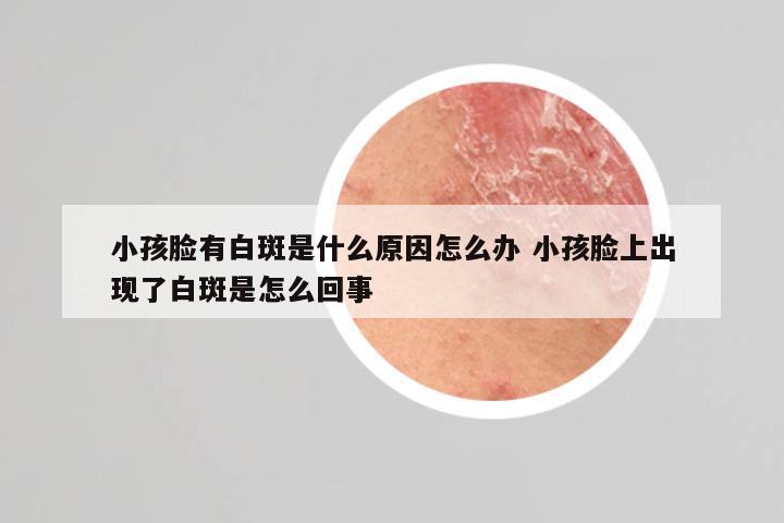 小孩脸有白斑是什么原因怎么办 小孩脸上出现了白斑是怎么回事