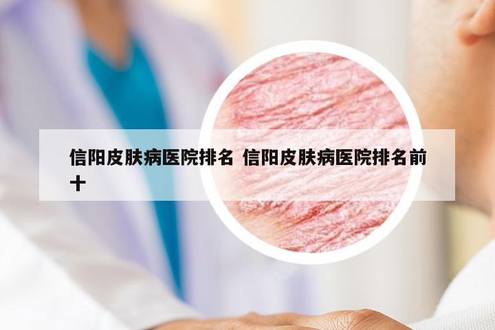 信阳皮肤病医院排名 信阳皮肤病医院排名前十