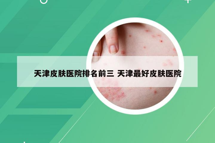 天津皮肤医院排名前三 天津最好皮肤医院