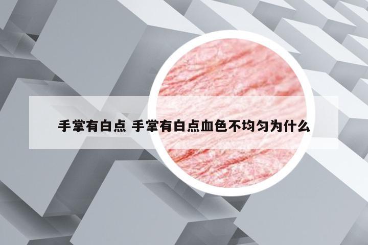 手掌有白点 手掌有白点血色不均匀为什么