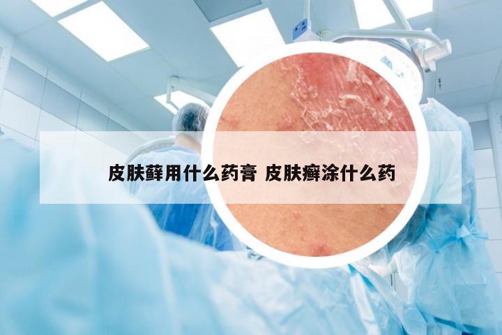 皮肤藓用什么药膏 皮肤癣涂什么药