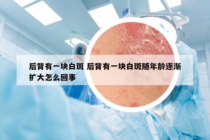 后背有一块白斑 后背有一块白斑随年龄逐渐扩大怎么回事