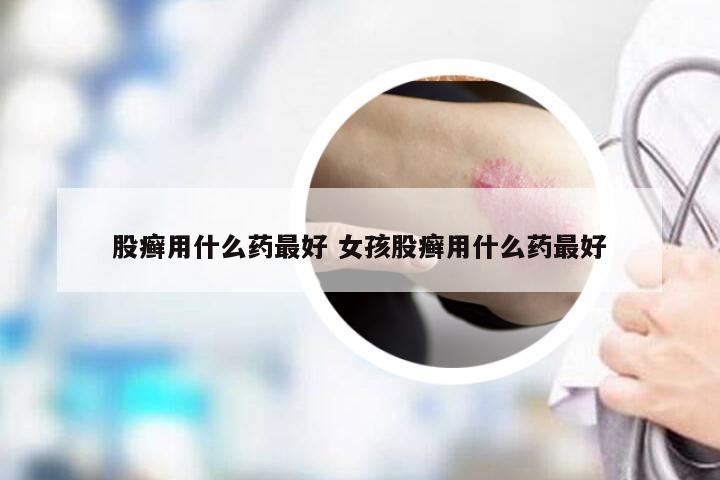 股癣用什么药最好 女孩股癣用什么药最好