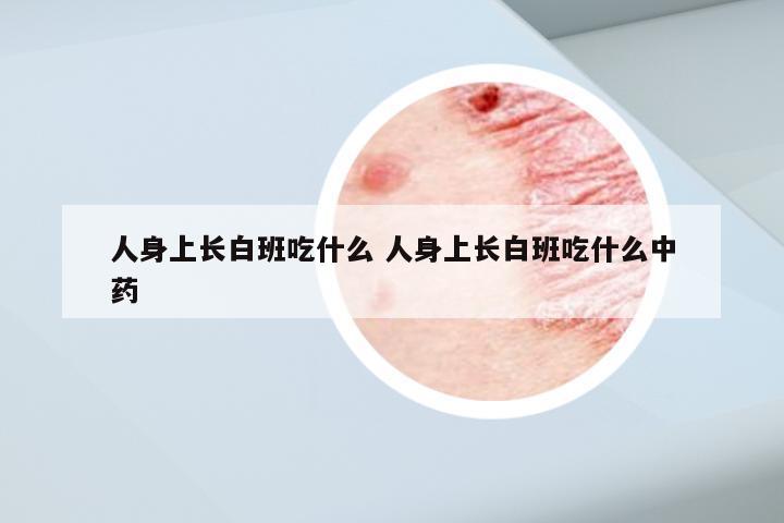 人身上长白班吃什么 人身上长白班吃什么中药